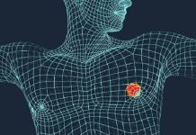 Tak Hanya Wanita, Kanker Payudara Juga Terjadi Pada Laki-laki loh. Yuk Simak