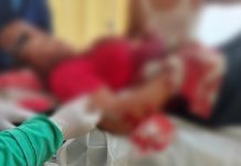 Diduga Cemburu, Suami Aniaya Mantan Istri Pakai Parang