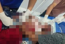 Bom Ikan Baru Dirakit Meledak, 1 Orang Tewas, Polisi Olah TKP